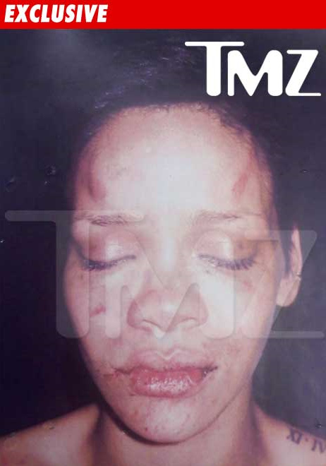 rihanna pictures after beating tmz. Rihanna#39;s Face After The Chris